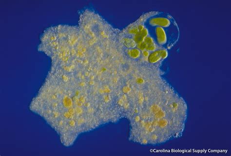  Pelomyxa: ¡Un gigante unicelular que desafía las expectativas de la vida microscópica!