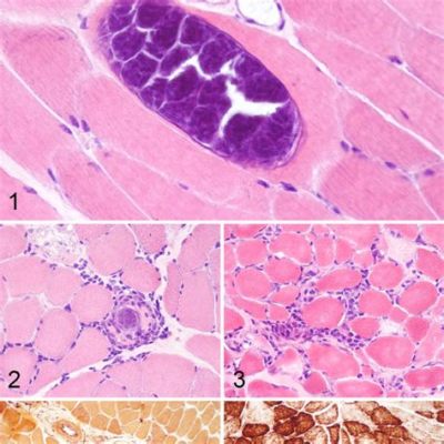  Sarcocystis: Un Parasito Misterioso que Transforma Músculos en Castillos de Protozoos!