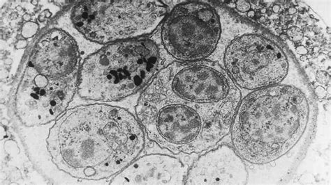  Taxoplasma gondii: ¡Un parásito astuto que controla las mentes de sus huéspedes!