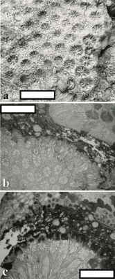  Isocyathus! Una Colonia Coralina que Puede Resistir la Más Fuerte Tormenta